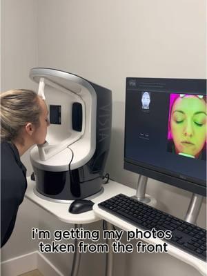 👩🏼‍🔬✨ Come with me for a VISIA Skin Analysis right here in Nashville! Ever wonder what’s really happening beneath your skin? The VISIA reveals it all—wrinkles, sun damage, pores, and more. This is your skincare blueprint to glowing, flawless skin. 💎 Start your 2025 glow-up with a personalized treatment plan tailored just for you🫶🏻 #NashvilleSkincare #VisiaSkinAnalysis #GlowUp2025 #LuxuryAesthetics #SkinGoals #nashvillemedspa #medspa #aestheticsRN #medspaRN 