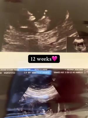 12 weeks with little miss🩷🎉 #fyp #fypシ #secondtimemom #pregnantmama #foryoupageofficiall #rainbowbaby🌈 #pregnant #pregnanttiktok #pregnanttok #momlife #motherhood #pregnancy #pregnancyjourney #pregnancytiktok #bumpupdate #babybump #12weekspregnant #babyloading #momofboth💙💗 #babygirl #pregnancylife 