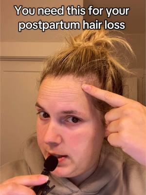 Postpartum hair loss on point. 🤌🏼 #postpartumjourney #postpartumrecovery #postpartumbody #postpartumhairloss #postpartumhair #ppa #pphairloss #pphairgrowth 