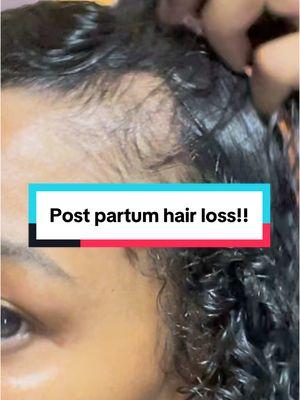 3 months PP and my edges are struggling. I’m educated on Ayurvedic practices that I know my hair loves so we’re going to kick it into hyperdrive to maintain my length and get these edges back. 👏🏾💕 . #pphairloss #postpartumhaircare #postpartumhairstyles #postpartumjourney 