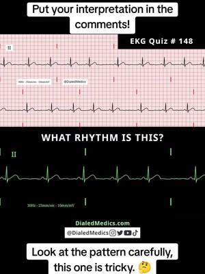 🫀🛑🤔 All #EKG recordings are from the EKG rhythm generator on my website (LII rhythms only for now, 12Ls are in beta and coming soon), be sure to check it out for more software generated #ECG practice! (Link in bio.) #EMS #ACLS #emstok #paramedic #paramedicsoftiktok #medic #medicsoftiktok #flightmedic #criticalcareparamedic #paramedicstudent #paramedicschool #emta #emtb #emt #emtlife #emtsoftiktok #emtstudent #emtschool #firstresponders #NREMT #nurse #nursesoftiktok #RN #nursingstudent #nursingschool #flightnurse #criticalcarenurse #emergencynurse #NCLEX #nclexrn #nclexprep #doctor #doctorsoftiktok #medicalstudent #USMLE #emergencymedicine #criticalcare #cardiology #foamed 