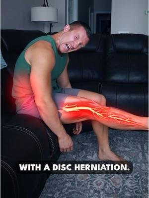 3 Test Disc Herniation Diagnosis and How to Fix It! #backpain #lowbackpainrelief #lowbackpain #sciaticatreatment #sciatica #backpainrelief #backpainexercises #discherniation #fitness #sciaticarelief #sciaticapain 