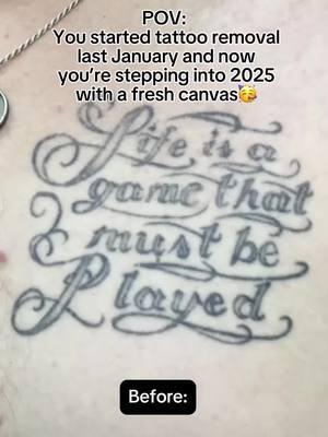 2025 is HERE✨ Get a head start on your goals now and see noticeable results sooner. ✨ Find a studio near you using our link in bio🔗 #removery #tattooremoval #lasertattooremoval #tattoo #tattoos #fading #tattoofading #fadingtattoos #tattoocoverup #removetattoos #ustattooremoval #australiatattooremoval #canadatattooremoval #extattoos #extattoo #exesnametattoo