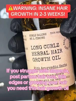 Shop using the 🔗 in our bio! #viral #naturalhair #ayurvedichaircare #indianhaircare #hairgrowthoils #blackfriday #hairconditioner #fasthairgrowth 