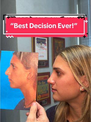 #rhinoplasty #deviatednose #drrodrohrich #bestplasticsurgeon @Newsweek #dallas #fyp #foryoupage #beforeandafter #rhinoplastybeforeandaafter #nose #rhinoplastyexpert 