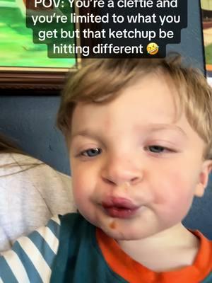 I’m very aware it’s coming out of his nose, he has a cleft lip what else do you expect 🤦🏻‍♀️ he over exaggerates so much.🤣 #fyp #foryou #boymama #cleftstrong #bilateralcleftlipandpalate #raregeneticdisorder #cleftawareness #familymatters #MentalHealthAwareness #babytok 