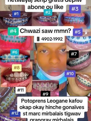 #braces #jhonbraces #brace #profilaksi #prophylaxie #prophylaxi #prophylaxis #prophylaxiejhonbraces #blanchissement #blanchimentdentaire #blanchiment #bracisse #dopeswaggerds #dopeswagger #brace #thx #God #merci #braces 