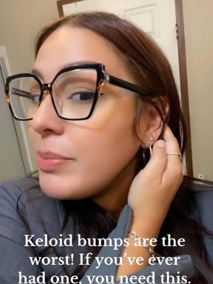 If you struggle with keloids, this is for you. #keloid #keloids 