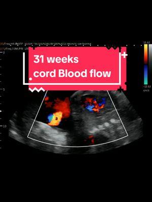 The Life Line! Isn't it beautiful?! Look at that Heart Beat! 😍 #heybabymobile #baby #pregnant #pregnancy #3rdtrimester #31weekspregnant #ultrasound #umbilicalcord #cordblood www.HeyBabyMobile.com