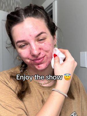 Enjoy the show 😇 you’re either gonna love it or hate it #picking #popping #sosatisfying #acne #acneskin #pimplepopping #whiteheads 