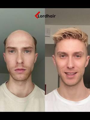 Say Hello to Your Best Hair Day, Every Day 👋 Hair: superskin-v in color22 Model: @juqqq  Code: TK10 #hairsystems #Lordhair #fyp #hairloss #hairlosssolutions #confidenceboost #hairpiece #menfashion #hairlosscommunity #beforeandafterchallenge #nonsurgicalhairreplacement #hairpieceshop #scalpcare #menwigs #hairpieceformen #lordhair #hairlinereceding