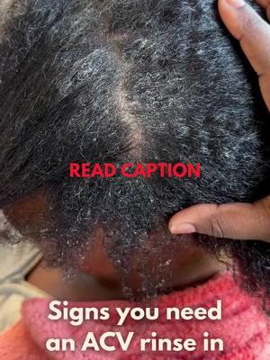 ✨ This is how you know it’s time to give your scalp the detox it deserves with Detox Galore!  ❗️Using heavy, cakey products like edge control, gels, mousse etc can cause your scalp to look like this in as little as 7-10 days.  ❌Constantly having an itchy or flaky scalp is not normal and should not be a constant concern for ANY natural!  ✅Our Herbal Apple Cider Vinegar Rinse is designed with you in mind. Infused with burdock root, basil leaf, and horsetail, it works to lift that stubborn build-up and nourish your scalp. Plus, the blend of lemongrass, ylang ylang, and lavender essential oils leaves your hair feeling fresh, light, and ready to thrive.  🛍️Shop our Detox Galore ACV rinse using the link in our bio to get rid of this issue!🛒📦 #viral #naturalhair #ayurvedichaircare #indianhaircare #hairgrowthoils #hairconditioner #applecidervinegarrinse #rosemaryhairoil 