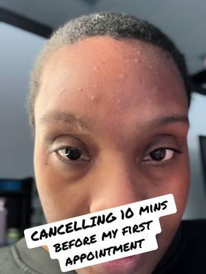 Sometimes things do happen to us frfr! #braider #braids #cancelled #hairappointment #columbiascbraider #columbiasc #allergic #allergicreaction #braidtherapy803