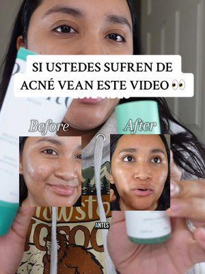 Definitivamente una de mis marcas favoritas de skincare 😻  #purito #skincare #acnegirly #acneskincare #acneskin #koreanskincare #puritoseoul #panthenolcream #puritopartner #honestreview #giftedcollab #honestthoughts 