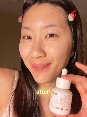 the @Innisfree US green tea enzyme vitamin C brightening serum is a staple in my routine now <3 #innisfree #innisfree_partner #vitacrapiddarkspotserum #darkspots #sephora 