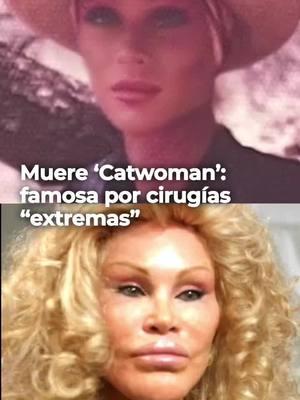 'Catwoman' tenía 84 años y falleció mientras dormía 🙏🏻🕊️🤍 #JocelynWildenstein #Catwoman #famosos #tendencia #viral #fypシ゚viral #noticias 