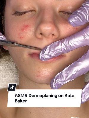 Replying to @Titoisthebestdogistheworld💕💕 We appreciate your kind words! Here is some more of Kate for you 😊 @Kate Baker Could not start the year off without getting rid of the deadskin buildup from the last year🥰✨ #asmrspa #asmrsleep #dallasmedspa #asmrdermaplaning #asmrskintracing #lolpodcast