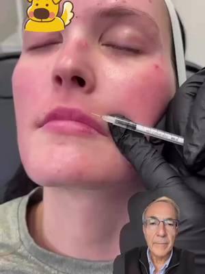 Test your anatomy! Is this treatment for radial lip lines OR a lip flip?! Comment your answer below!👇🤔 Learn how to do this and much more at facialesthetics.org  Learn it. Live it. Give it!  Get AAFE Certification trained today! ° °  ° #AAFE #aafecertified #esthetics #facialesthetics #botox #filler #education  