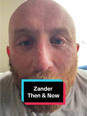 Zander was a #wild one for sure. A true #testimony to what the program of #alcoholicsanonymous can do for anyone and everyone who wants to get #sober. Super #proud of you Zander ❤️ keep up the good work! 