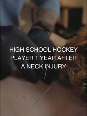 Hockey Player 1 Year After A Neck Injury #hockey #DryNeedling #physio #AthleteRecovery 