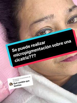 Respuesta a @A.or2024  Realizando Micropigmentación sobre una cicatriz #respondiendocomentarios #clientasfelices #maitebeauty84 #micropigmentacion #cejasperfectas #paratii 