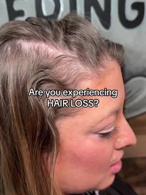 Are you experiencing HAIR LOSS? Message us for a VIRTUAL Consultation! We can’t wait to help you! #jnielfringe #hairdreams #hairloss #hairtopper #thinninghair #thinnhairsolutions #hairtoppers #hairtoppersforthinninghair #finehair #hairextenions #womenhairloss 