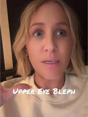 All I want this year is an upper eye bleph. I don’t care that. I’m under 40. I don’t care if you think I look good the way I am. I want one. So now we gotta find a surgeon. #uppereyelidsurgery #bleph #blepharoplastie #eyelidsurgery 