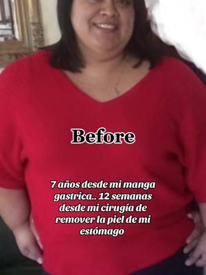 #bossbabehilda #weightlossmotivation #weightloss #thisis50 #curvy  #curvyfit #cincuentona #mangagastrica #bariatrica #motivacion 