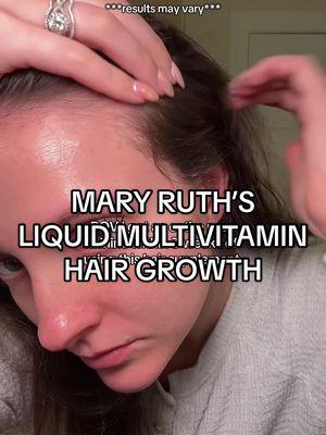 SHOCKED is an understatement. I thought all the reviews on this were exaggerations until I started it for myself. Absolutely love this stuff!#maryruthsorganics #maryruthsmorningmultivitamin #maryruths #hairvitamins #supplement #hairsupplement #hairgrowth #thinninghair #postpartumhairloss #recedinghairline #hairloss #hormonalhairloss #tiktokshopmusthaves #tiktokshopnewarrivals #tiktokshopmademebuyit #newyearnewaura #tiktokshopcreatorpicks #yearendsale #tiktokshopyearendsale 