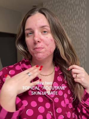 DAY 2 POST AEROLASE LASER UPDATE ON CYSTIC ACNE SKIN [round two]  @Sydneyhuntleyesthetics @Aerolase® Laser Skin Health #acne #acneskin #acnetreatment #acnelaser #aerolase #facelaser #pcos #pcostreatment #unwantedhair #laserhair #laserhairremoval #pcosproblems #accutane #acnescars #guthealth #integrativemedicine