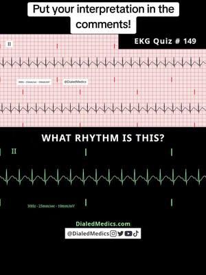 ⏩🫀🤔 All #EKG recordings are from the EKG rhythm generator on my website (LII rhythms only for now, 12Ls are in beta and coming soon), be sure to check it out for more software generated #ECG practice! (Link in bio.) #EMS #ACLS #emstok #paramedic #paramedicsoftiktok #medic #medicsoftiktok #flightmedic #criticalcareparamedic #paramedicstudent #paramedicschool #emta #emtb #emt #emtlife #emtsoftiktok #emtstudent #emtschool #firstresponders #NREMT #nurse #nursesoftiktok #RN #nursingstudent #nursingschool #flightnurse #criticalcarenurse #emergencynurse #NCLEX #nclexrn #nclexprep #doctor #doctorsoftiktok #medicalstudent #USMLE #emergencymedicine #criticalcare #cardiology #foamed 