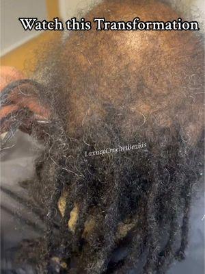 Watch this amazing transformation! Crochet braids for my beautiful client with alopecia. #crochetbraids #fyp #creatorsearchinsights #crochetbraidstyles #crochetbraidstutorial #alopecia 