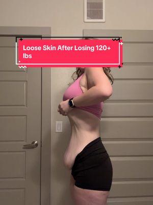 TikTok please don’t remove this🤣 it’s for educational purposes #weightloss #extremeweightloss #wls #fitness #weightlosssurgery #vsg #bariatricsurgery #gastricbypass #skinremovalsurgery #looseskin #tummytuck #FDL #armlift 