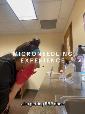 Microneedling & PRP appointment! (1st appointment)  #microneedling #prp #plasma #microneedlingface #microneedlingtherapy #esthetician #botox #skincare #momvlog #Vlog #ditl #ditlofamom #ditlvlog #Mirandahowell #SelfCare #weighloss #100poundsdown #100poundweightlossjourney #wrinkles #skincareroutine 