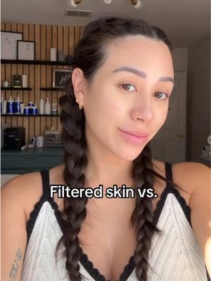 This was casually sitting in my drafts 🙃  THIS IS YOUR REMINDER TO STOP COMPARING YOURSELF TO OTHERS ON SOCIAL MEDIA! With filters readily available for everyone it’s easy for us to sit and compare our skin to others. No one is perfect! REAL SKIN IS BEAUTIFUL 🫶🏼 #filter #filters #beautyfilters #socialmedia #realskin #realskintexture #skincare #skincaretips #skin 