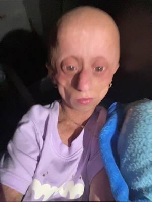 Random🧍🏽‍♀️#workwithartists #yokoremix #progeria #foryoupageofficiall #foryoupage #fypシ゚viral #viralvideo #paratiiiiiiiiiiiiiiiiiiiiiiiiiiiiiii 