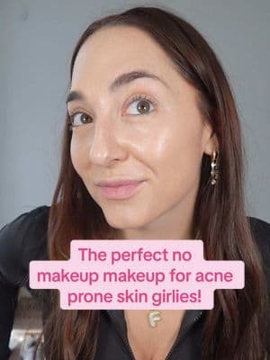 Acne prone skin girlies why has NO ONE told me about this??? Am I behind? I think I am but idc this is giving skinnnnnnnn! What do we think!! #skincare #skin #skincareroutine #acne #acnescarring #skinbarrierrepair #acnescars #acnetreatment #skintok #clearskintips #skincareresults #acnebeforeandafter #clearskinproducts #skinbarrier #skincaretips #clearskin #clearskinroutine #hormonalacne #hormonalimbalance #balanceyourhormones #accutane