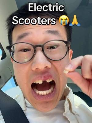 Never stepping foot on an electric scooter again 😭🙏 #electricscooter #scooter #scooters #skillissue #cooked #felloff #scooteraccident #tonytechbytes 