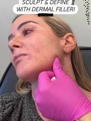 This injection technique will help define the angle of the mandible! 😆‼️ Learn how to do this and much more at facialesthetics.org  Learn it. Live it. Give it!  Get AAFE Certification trained today! ° °  ° #AAFE #aafecertified #esthetics #facialesthetics #botox #filler #education  