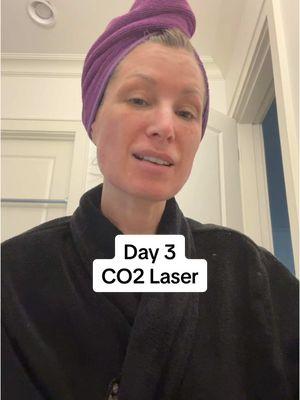 CO2 Laser day 3 🍅😅 #co2 #co2laser #co2skinresurfacing #skinlaser #laserskincare #melasma #melasmatreatment #acnescars #fractionallaser #hyperpigmentation #over40 #acnescartreatment #perimenopause 