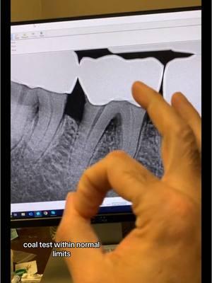 A thorough examination is a must. #endodontics #endodontist #dentistry #dentist #dentists #dentistryschool #dentalschool #dentalhygienist #dentalassistant #rootcanal #rootcanaltherapy #toothache #tooth #teeth 