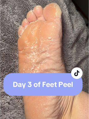 Can’t believe this is what I’m putting on the internet - oh well 😂  #footpeelmask #feetpeeling #feetpeelmask #plantifique #plantifiquefootmask #callusremoval #callusremover #callus #smoothfeet #newyearnewaura  