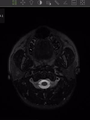 check out my brain 🧠🫣 #mri #brain #fyp #imaging #health #lesion