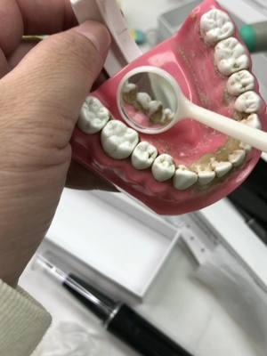 Teeth cleaning stone can be processed by oneself #oralhygiene #oralcavity #badbreath #fyp #nbgrlvs #tiktok #goodthing 