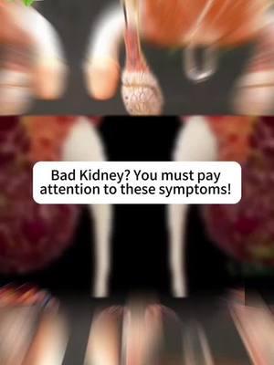 #kidneyfailure #kidneystone #Recipe #kidneydisease #health #kidney #fyp #kidneycancer 