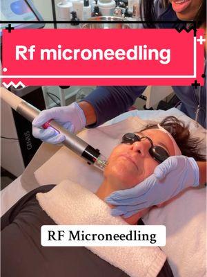 ✨ Ready to level up your skincare game? Let me spill the tea on why RF microneedling is your skin's new BFF! Think of it as the overachiever of aesthetic treatments - not only does it create those tiny channels for collagen production, but that radiofrequency energy goes deep to give you that extra oomph. 🔥 You'll obsess over how it tackles multiple concerns at once (hello, texture AND tightening!), plus the minimal downtime means you can get back to slaying your daily life ASAP. And the best part? If you're seeing early signs of aging, have mild skin laxity, or just want to maintain that gorgeous glow, you're probably the perfect candidate! So if you're ready to get that lit-from-within look, let's chat about making RF microneedling your next skin investment. 💫 #nursingaesthetics #RFmicroneedling #GlowUp #skincarescience