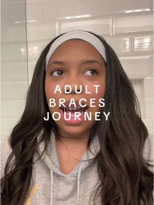 clearing out the drafts! I got 5 more months 🥲🥳 #adultbraces #adultbracescheck #bracestips #bracesjourney #ceramicbraces 