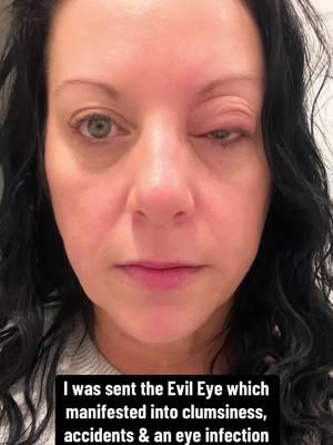 I had a definite run in with the evil eye after going no contact with toxic family members #fyp #theevileye #malocchio #malocchioremoval #evileyeprotection #protectionspell #witchtok #returntosender #beforeandafter #witchcraft101 