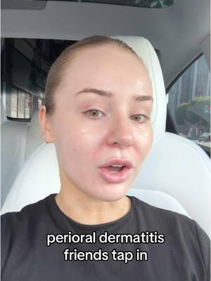 is this too niche? 🫠 #perioraldermatitis #skintok 