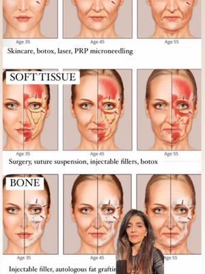 A plastic surgeon’s approach to analyzing the face when it comes to facial aging #beautyisinthedetails #devganoptimization #facialoptimization #boardcertifiedplasticsurgeon 